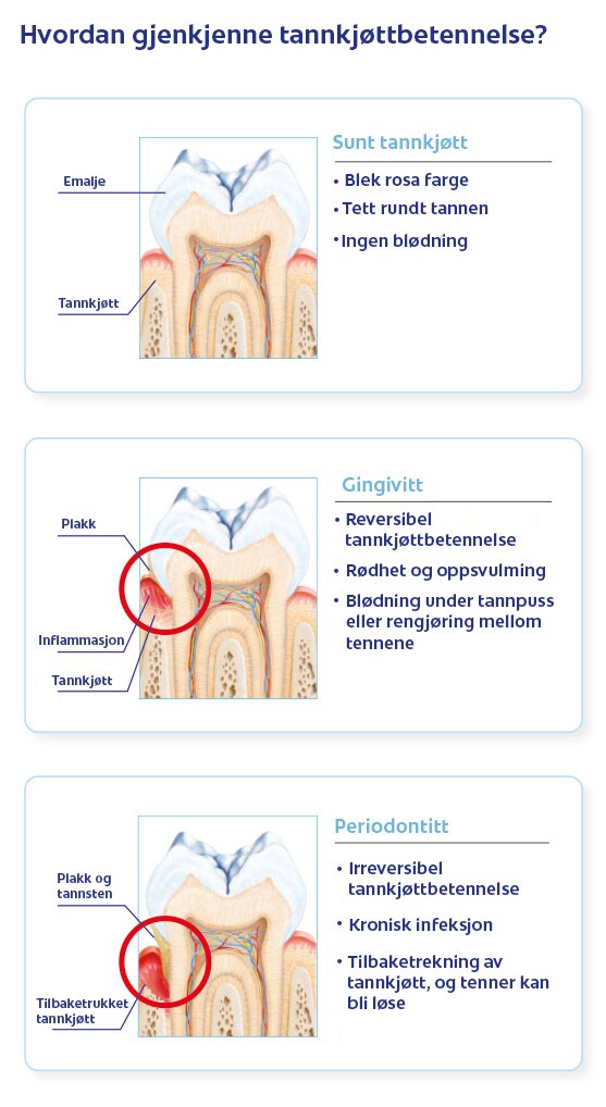 Etiologi, årsaker og symptomer