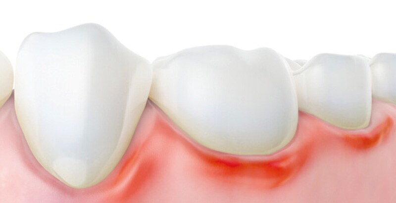 Innvirkning på pasientens livskvalitet