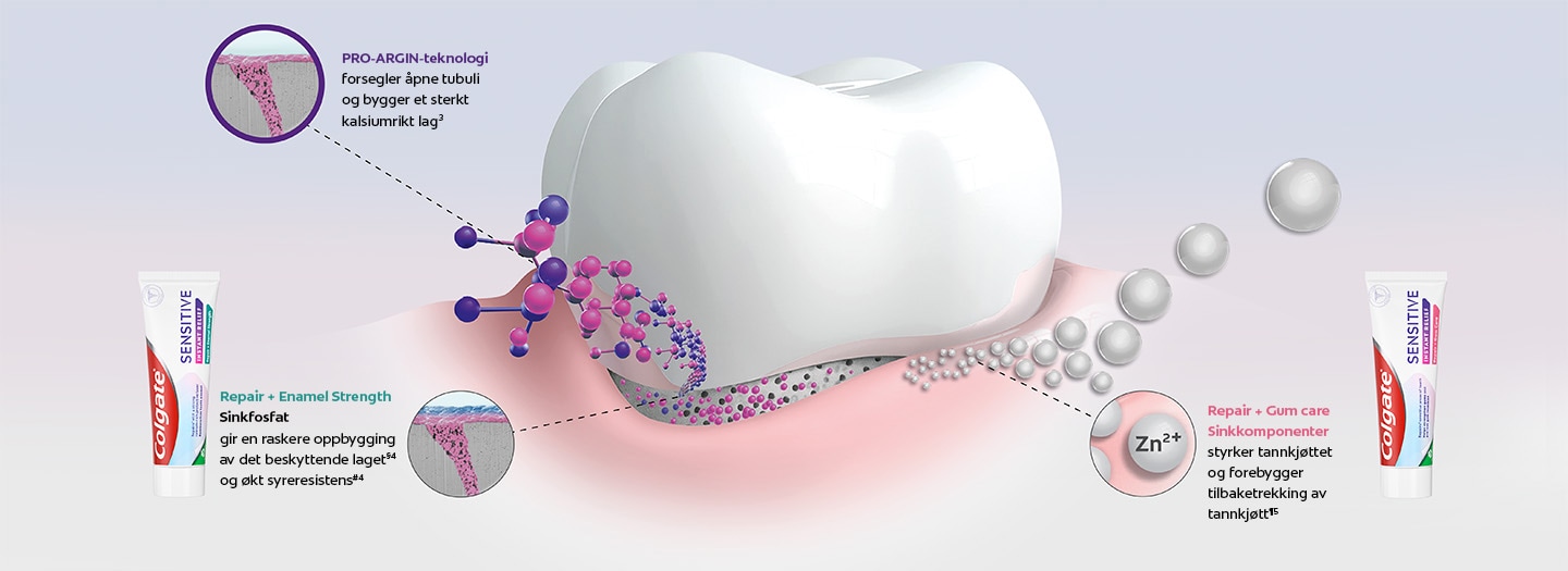 infografik, der viser PRO-ARGIN-teknologiens effekt på tandfølsomhed forsegler åbne tubuli og danner et stærkt calciumrigt lag. Colgate CSPR Repair + Enamel Strength tandpasta, der hjælper med Zinkfosfatgiver hurtigere opbygning af det beskyttende lag og øget syreresistens. Og Colgate CSPR Repair + Gum care tandpasta, der hjælper med Zinkkomponenterstyrker tandkødet og forebygger recession